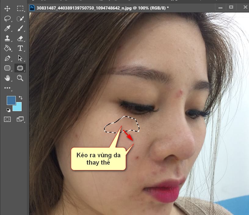 Cách Xóa Mụn Cực Nhanh Bằng Photoshop 10 kéo ra vùng da thay thế