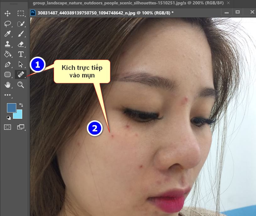 Cách Xóa Mụn Cực Nhanh Bằng Photoshop 6 kích trực tiếp vào mụn
