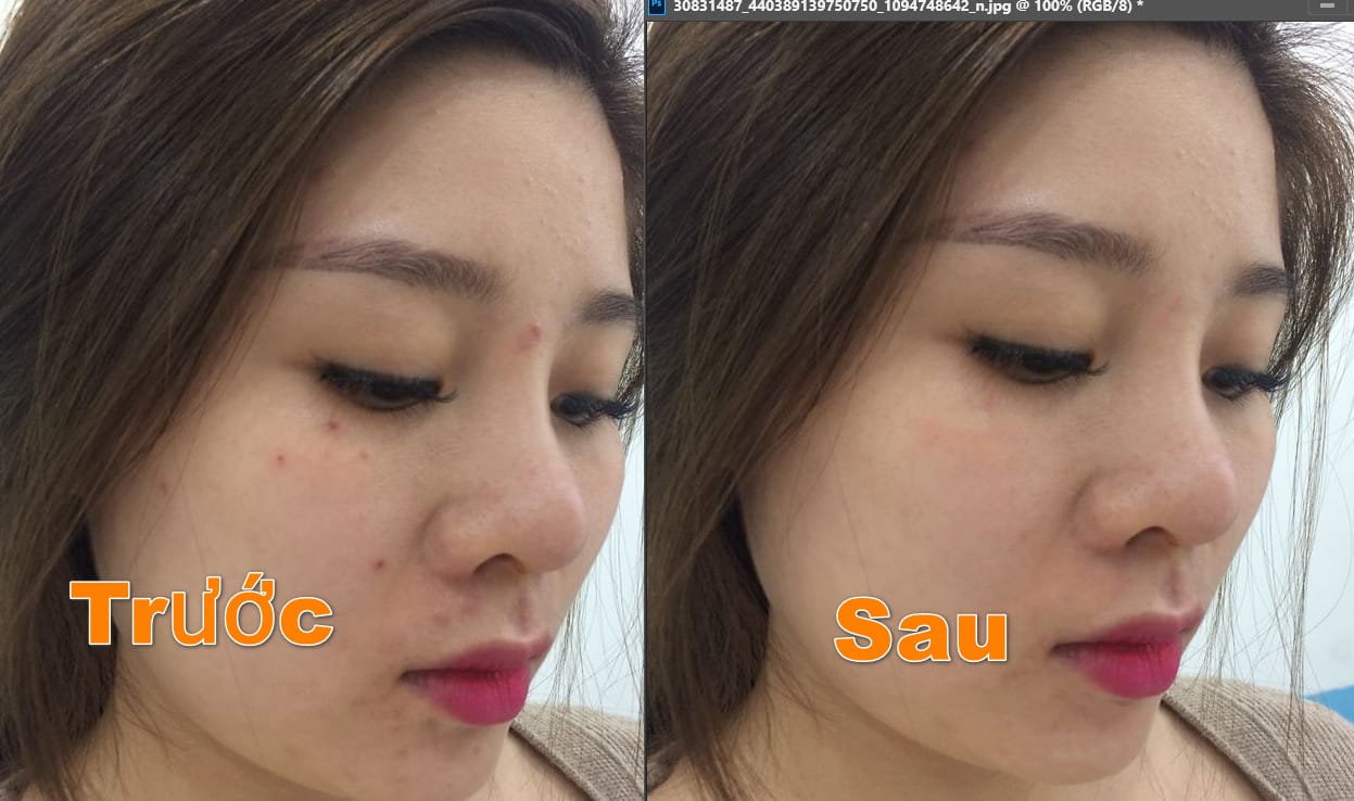 Cách Xóa Mụn Cực Nhanh Bằng Photoshop 7 xoa mun dep nhanh trong photoshop